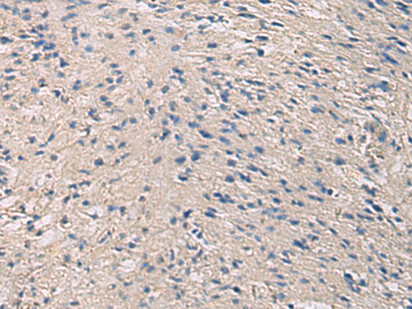 Anti-PRKCSH Rabbit Polyclonal Antibody