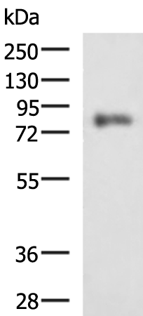 Anti-PRKCSH Rabbit Polyclonal Antibody