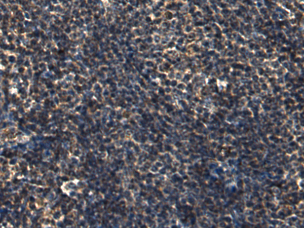 Anti-PSTPIP1 Rabbit Polyclonal Antibody