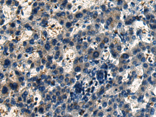 Anti-EVL Rabbit Polyclonal Antibody
