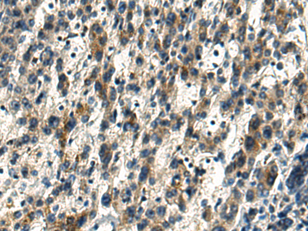 Anti-ARMT1 Rabbit Polyclonal Antibody