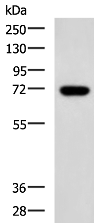 Anti-ENTPD4 Rabbit Polyclonal Antibody