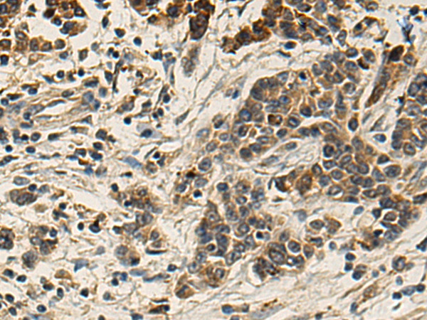 Anti-DNAI2 Rabbit Polyclonal Antibody