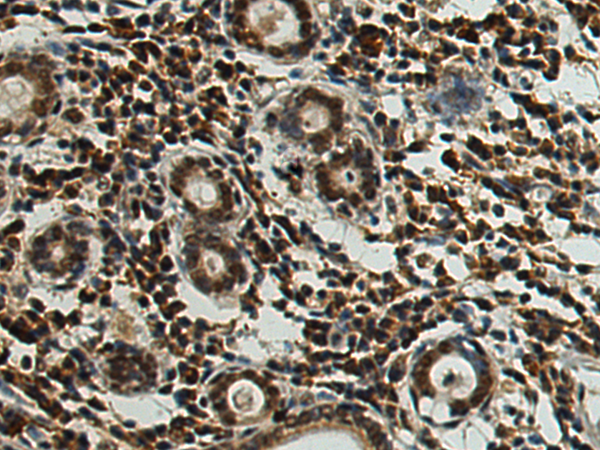 Anti-HEXIM2 Rabbit Polyclonal Antibody