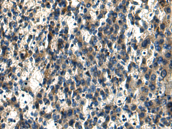 Anti-MTG2 Rabbit Polyclonal Antibody