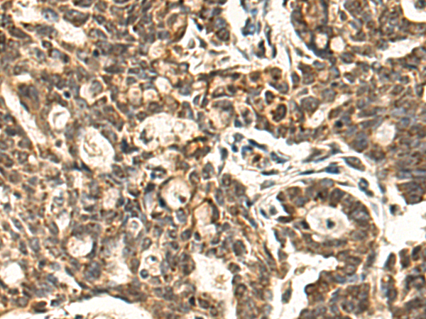 Anti-GALNT3 Rabbit Polyclonal Antibody