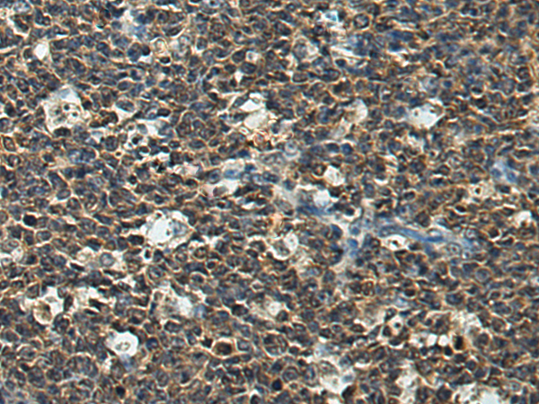 Anti-IDI2 Rabbit Polyclonal Antibody