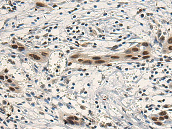 Anti-EBF3 Rabbit Polyclonal Antibody