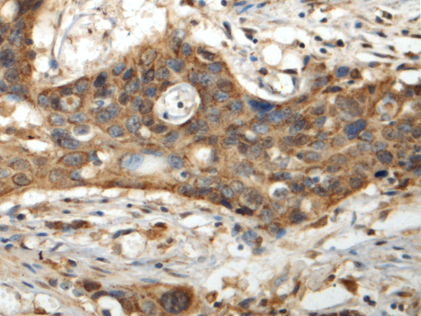 Anti-IQCC Rabbit Polyclonal Antibody