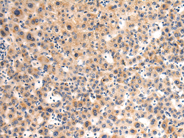 Anti-GLT8D1 Rabbit Polyclonal Antibody
