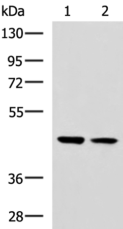 Anti-GLT8D1 Rabbit Polyclonal Antibody