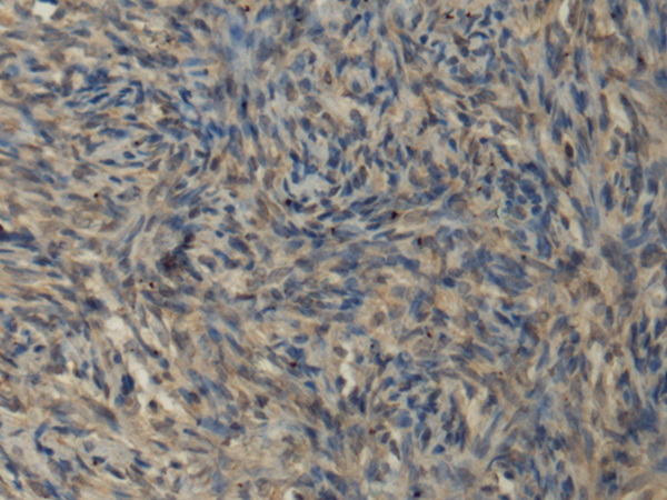 Anti-IL-1 Receptor Like 2 Rabbit Polyclonal Antibody