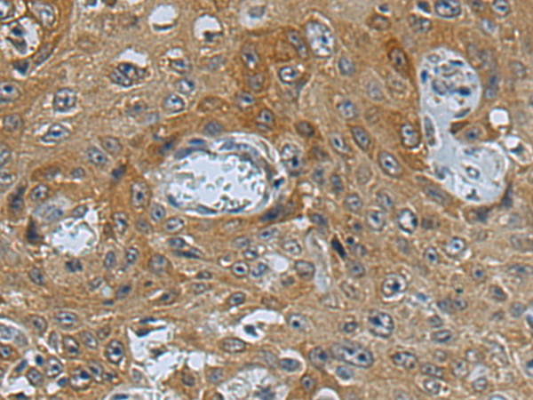 Anti-OXSM Rabbit Polyclonal Antibody