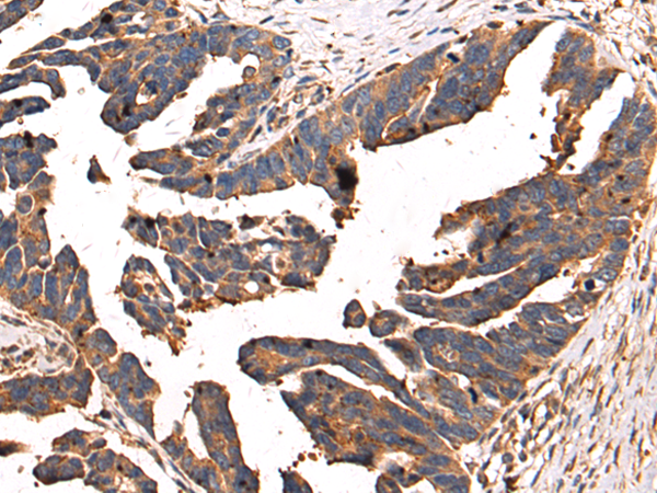 Anti-SUCLA2 Rabbit Polyclonal Antibody
