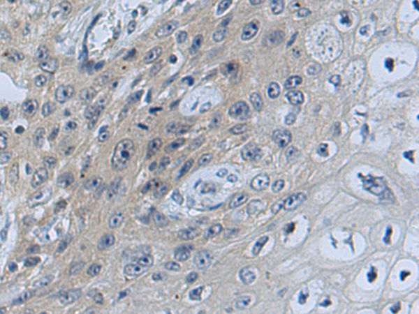 Anti-SNX17 Rabbit Polyclonal Antibody
