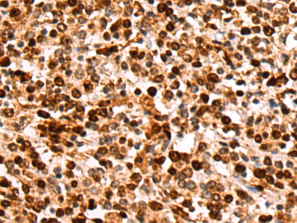 Anti-ZNF639 Rabbit Polyclonal Antibody
