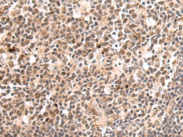 Anti-TOE1 Rabbit Polyclonal Antibody