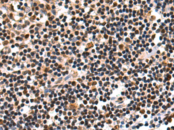 Anti-RPUSD2 Rabbit Polyclonal Antibody