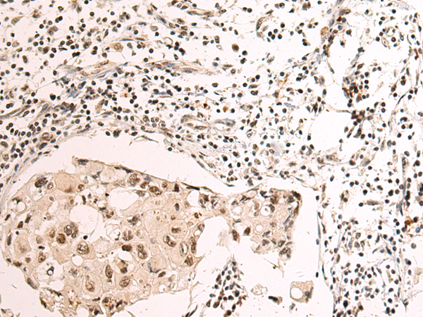 Anti-NOP58 Rabbit Polyclonal Antibody