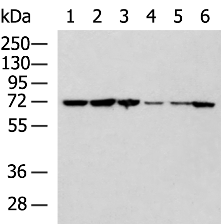 Anti-NOP58 Rabbit Polyclonal Antibody