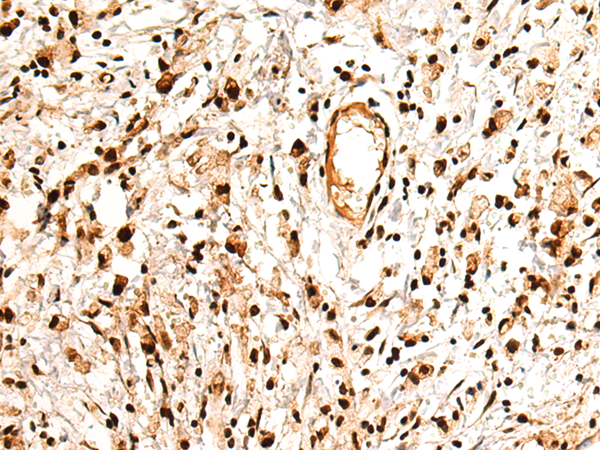 Anti-PTBP2 Rabbit Polyclonal Antibody