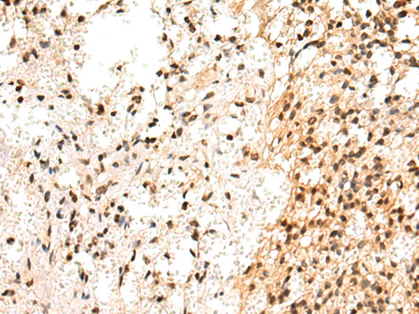Anti-SP110 Rabbit Polyclonal Antibody