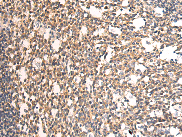Anti-PTCD3 Rabbit Polyclonal Antibody