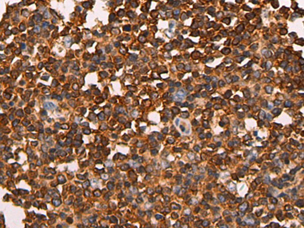 Anti-RHPN2 Rabbit Polyclonal Antibody