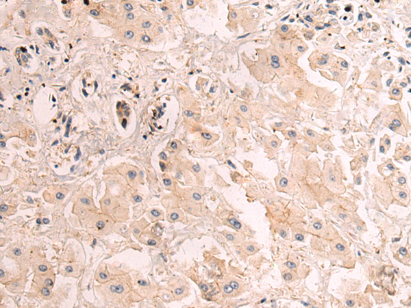 Anti-PLOD3 Rabbit Polyclonal Antibody