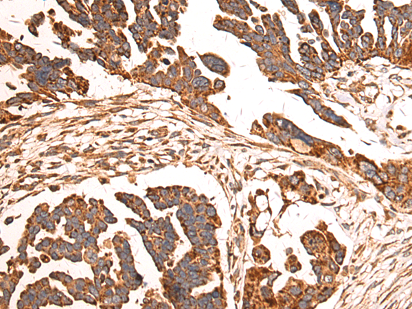 Anti-LETM1 Rabbit Polyclonal Antibody
