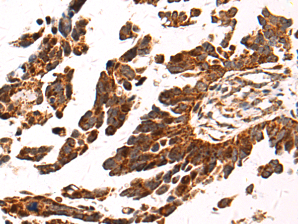 Anti-ZNF184 Rabbit Polyclonal Antibody