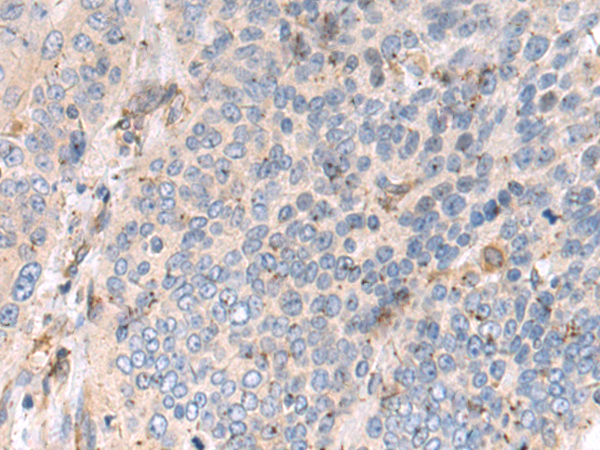 Anti-VARS1 Rabbit Polyclonal Antibody