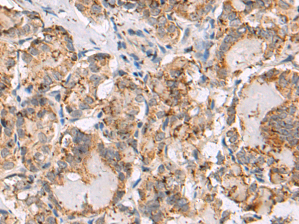 Anti-CIB2 Rabbit Polyclonal Antibody