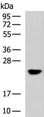 Anti-CIB2 Rabbit Polyclonal Antibody