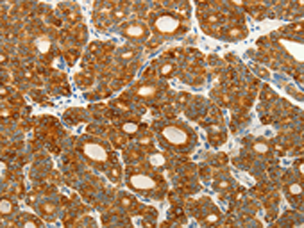 Anti-VEGFB Rabbit Polyclonal Antibody