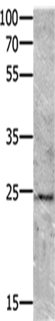 Anti-VEGFB Rabbit Polyclonal Antibody
