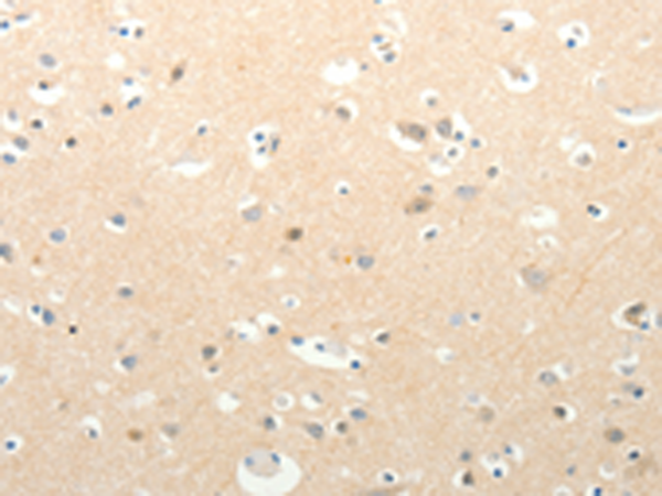 Anti-SLC18A1 Rabbit Polyclonal Antibody