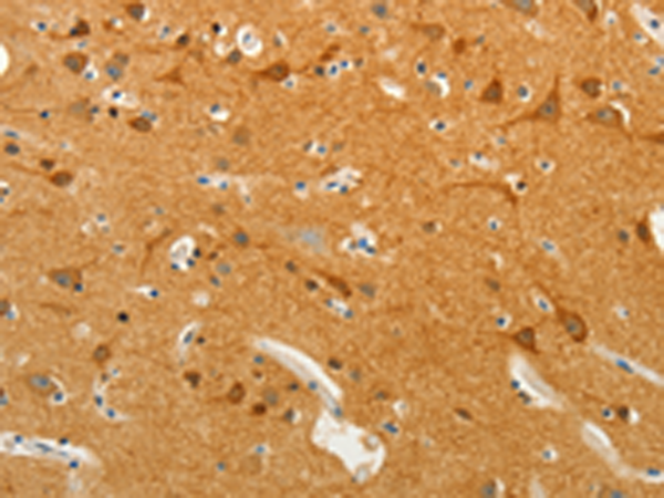 Anti-VAT2 Rabbit Polyclonal Antibody
