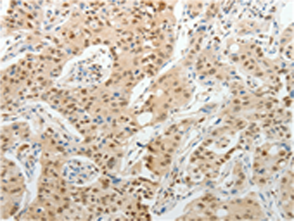 Anti-UNC5CL Rabbit Polyclonal Antibody
