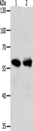 Anti-UNC5CL Rabbit Polyclonal Antibody