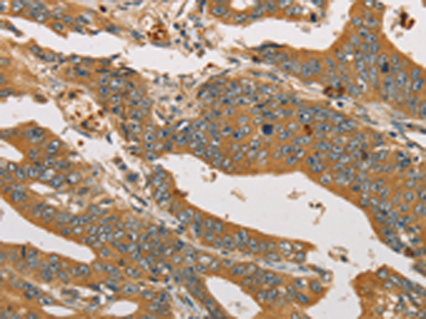 Anti-XPR1 Rabbit Polyclonal Antibody