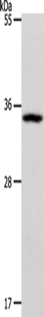 Anti-BUD23 Rabbit Polyclonal Antibody
