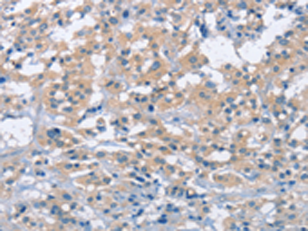 Anti-ZAP70 Rabbit Polyclonal Antibody
