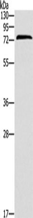 Anti-ZAP70 Rabbit Polyclonal Antibody