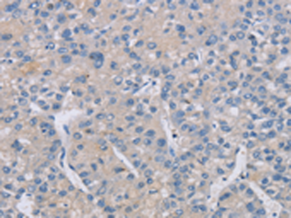 Anti-CREBZF Rabbit Polyclonal Antibody