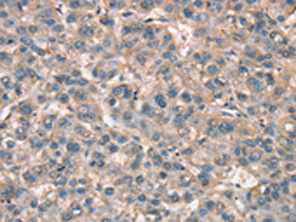 Anti-ZFYVE19 Rabbit Polyclonal Antibody