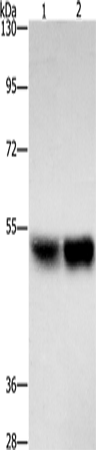 Anti-ZFYVE19 Rabbit Polyclonal Antibody