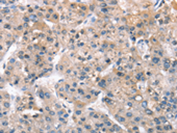 Anti-ZFYVE19 Rabbit Polyclonal Antibody