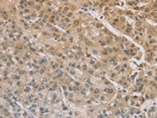 Anti-ZIC 2 Rabbit Polyclonal Antibody