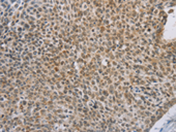 Anti-ZIC 3 Rabbit Polyclonal Antibody